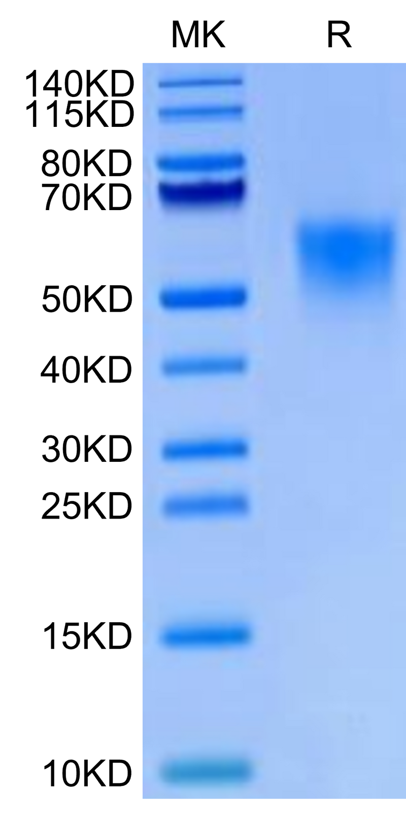 Biotinylated Cynomolgus IL-18BP on Tris-Bis PAGE under reduced condition. The purity is greater than 95%.Biotinylated Cynomolgus IL-18BP Protein (Primary Amine Labeling), Active