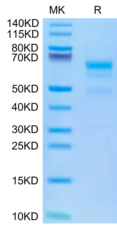 Human ULBP-4 on Tris-Bis PAGE under reduced condition. The purity is greater than 95%.Recombinant Human ULBP-4 Protein, Active