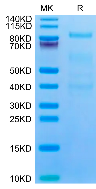 Mouse Complement factor I on Tris-Bis PAGE under reduced condition. The purity is greater than 90%.Recombinant Mouse Complement factor I Protein