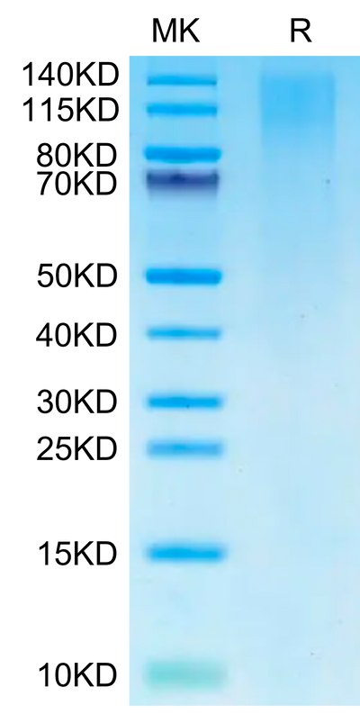 Cynomolgus TIM-1 on Tris-Bis PAGE under reduced condition. The purity is greater than 95%.Recombinant Cynomolgus TIM-1/HAVCR1 Protein