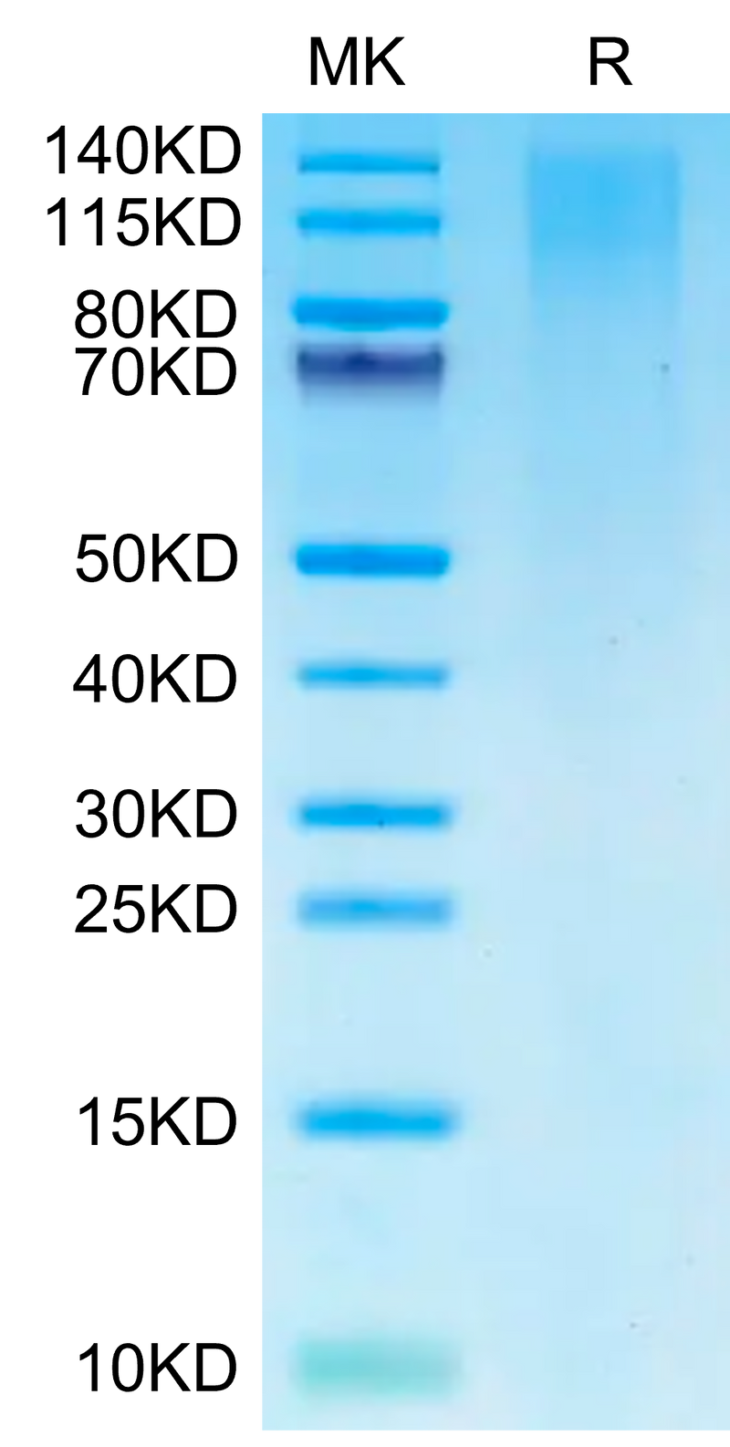 Cynomolgus TIM-1 on Tris-Bis PAGE under reduced condition. The purity is greater than 95%.Recombinant Cynomolgus TIM-1/HAVCR1 Protein