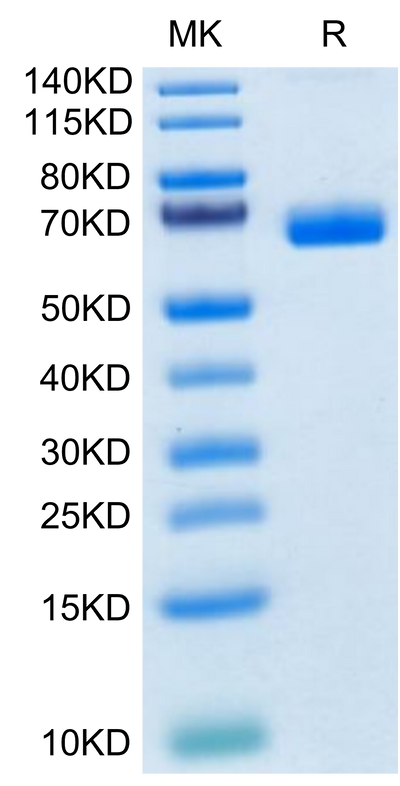 Cynomolgus NKp46 on Tris-Bis PAGE under reduced condition. The purity is greater than 95%.Recombinant Cynomolgus NKp46/NCR1/CD335 Protein, Active