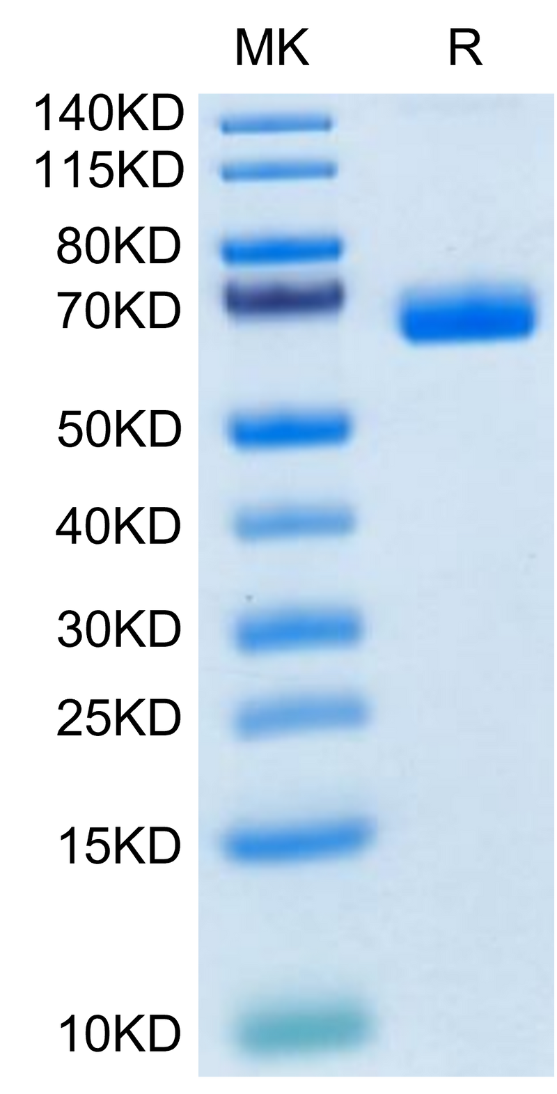 Cynomolgus NKp46 on Tris-Bis PAGE under reduced condition. The purity is greater than 95%.Recombinant Cynomolgus NKp46/NCR1/CD335 Protein, Active