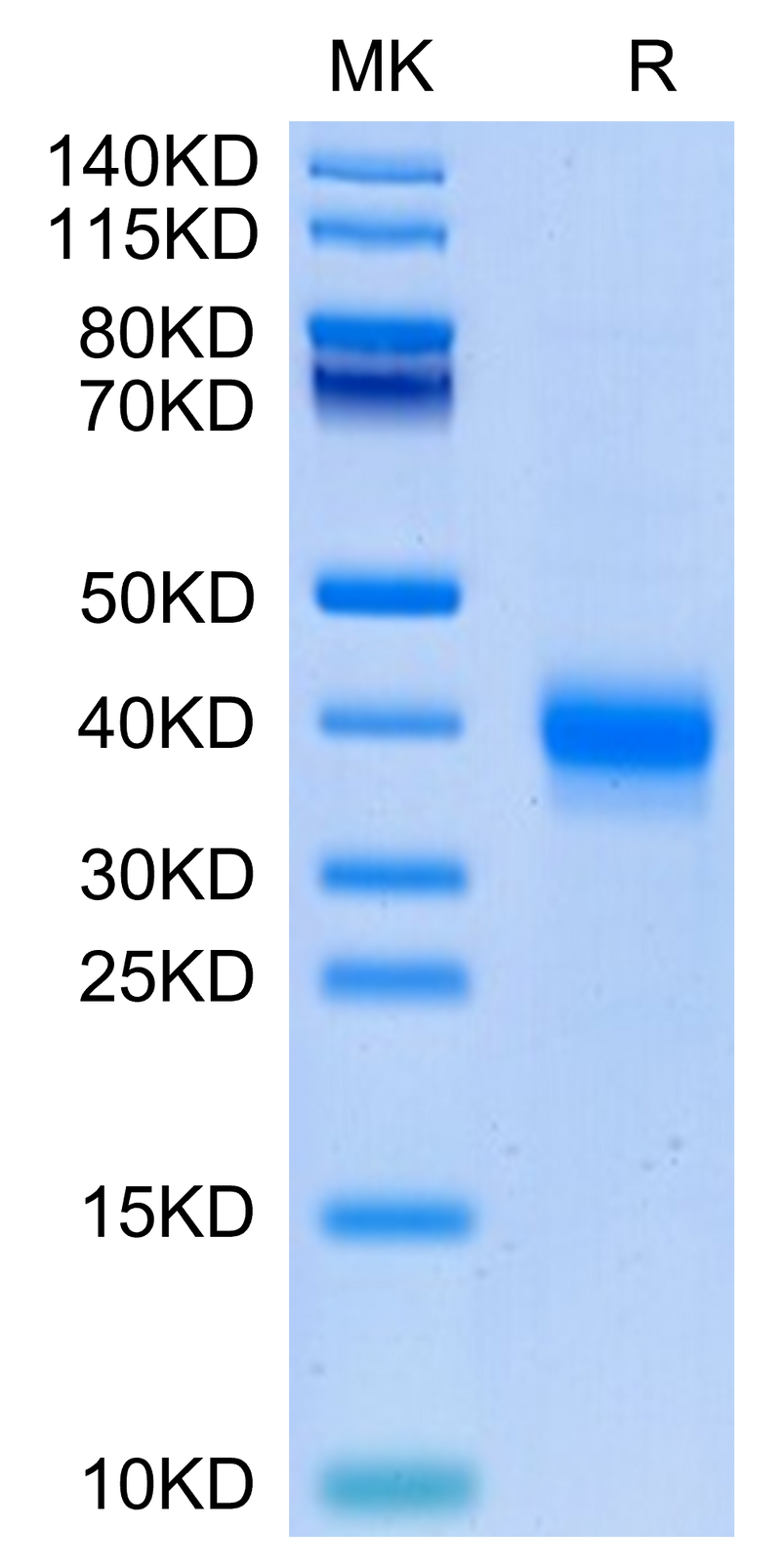 Cynomolgus CD2 on Tris-Bis PAGE under reduced condition. The purity is greater than 95%.Recombinant Cynomolgus CD2/SRBC Protein, Active