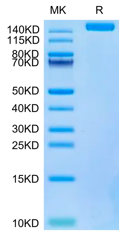 Biotinylated SARS-COV-2 Spike S Trimer on Tris-Bis PAGE under reduced condition. The purity is greater than 95%.Biotinylated SARS-COV-2 Spike S Trimer Protein, Active