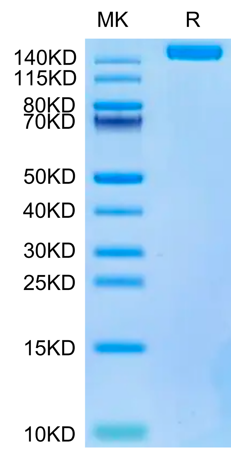 Biotinylated SARS-COV-2 Spike S Trimer on Tris-Bis PAGE under reduced condition. The purity is greater than 95%.Biotinylated SARS-COV-2 Spike S Trimer Protein, Active