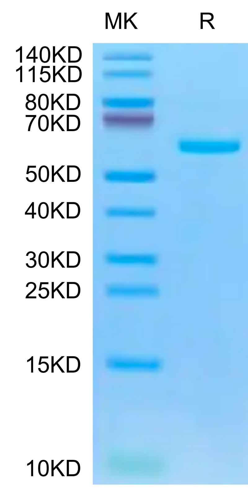 Biotinylated SARS-COV-2 Spike RBD on Tris-Bis PAGE under reduced condition. The purity is greater than 95%.Biotinylated SARS-COV-2 Spike RBD Protein, Active