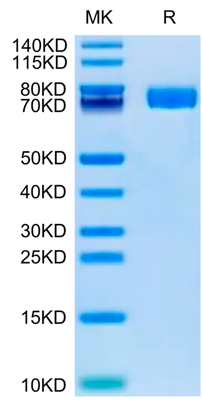 Human Fibronectin (32-602) on Tris-Bis PAGE under reduced condition. The purity is greater than 95%.Recombinant Human Fibronectin (32-602) Protein