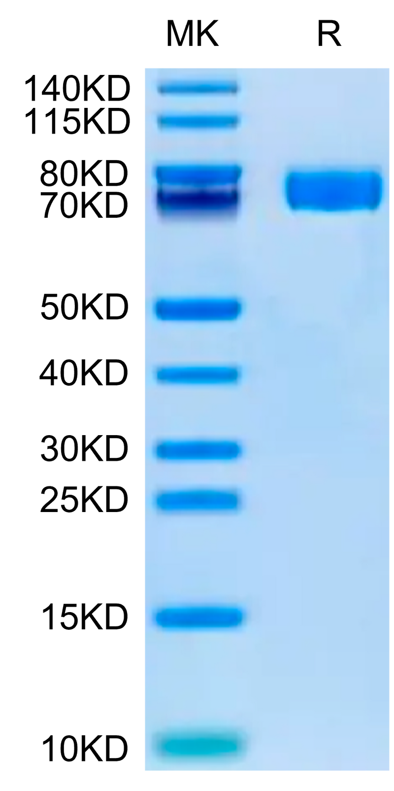 Human Fibronectin (32-602) on Tris-Bis PAGE under reduced condition. The purity is greater than 95%.Recombinant Human Fibronectin (32-602) Protein