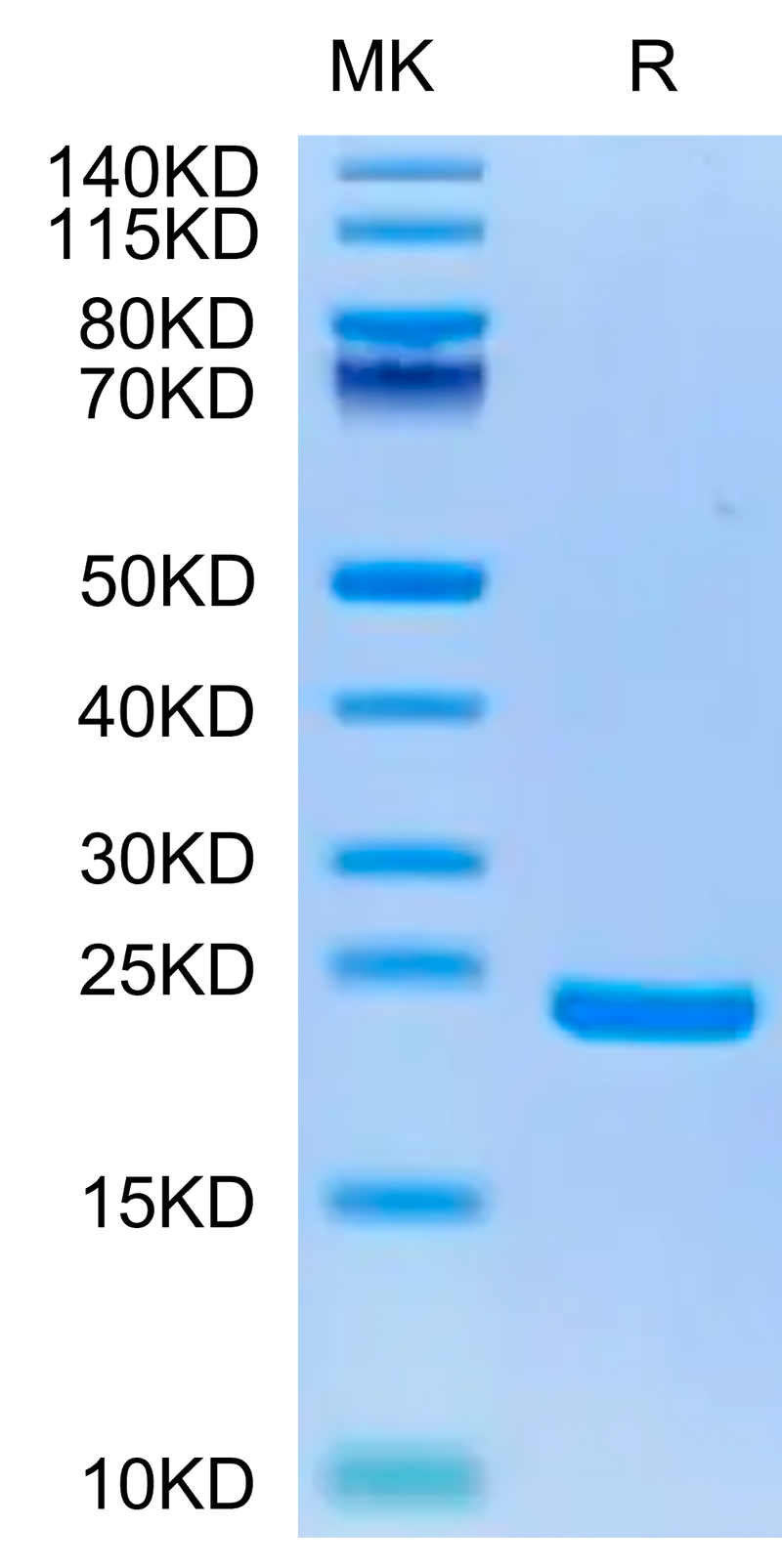 Biotinylated Human Midkine on Tris-Bis PAGE under reduced condition. The purity is greater than 95%.Biotinylated Human Midkine Protein