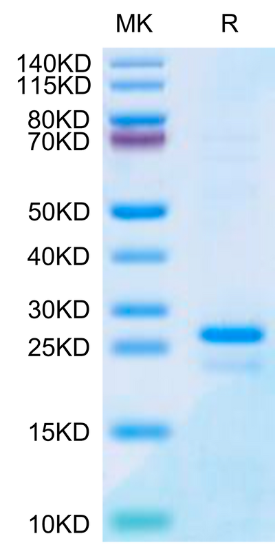 Human SP17 on Tris-Bis PAGE under reduced condition. The purity is greater than 95%.Recombinant Human SP17 Protein