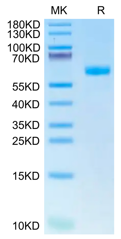 Human CDH17 Domain 6-7 on Tris-Bis PAGE under reduced condition. The purity is greater than 95%.Recombinant Human CDH17/Cadherin 17 Domain 6-7 Protein