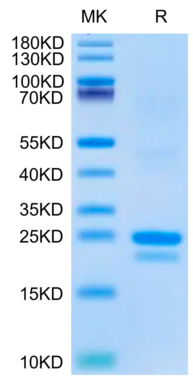 Mouse SP17 on Tris-Bis PAGE under reduced condition. The purity is greater than 95%.Recombinant Mouse SP17 Protein