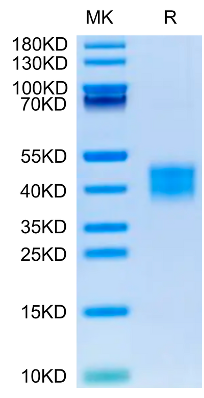 Mouse ASGR1 on Tris-Bis PAGE under reduced condition. The purity is greater than 95%.Recombinant Mouse ASGR1 Protein