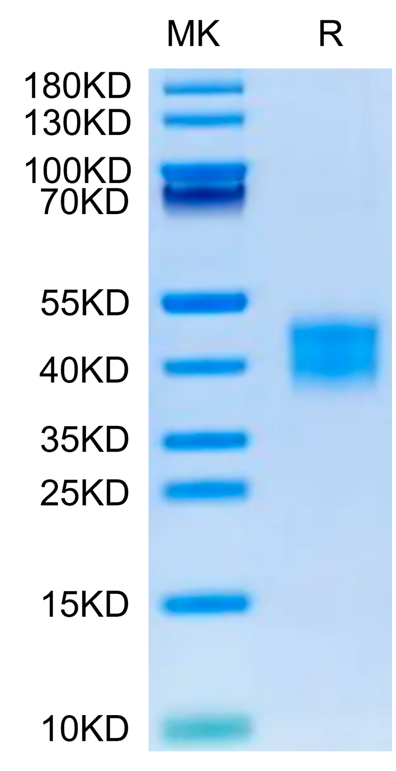 Mouse ASGR1 on Tris-Bis PAGE under reduced condition. The purity is greater than 95%.Recombinant Mouse ASGR1 Protein