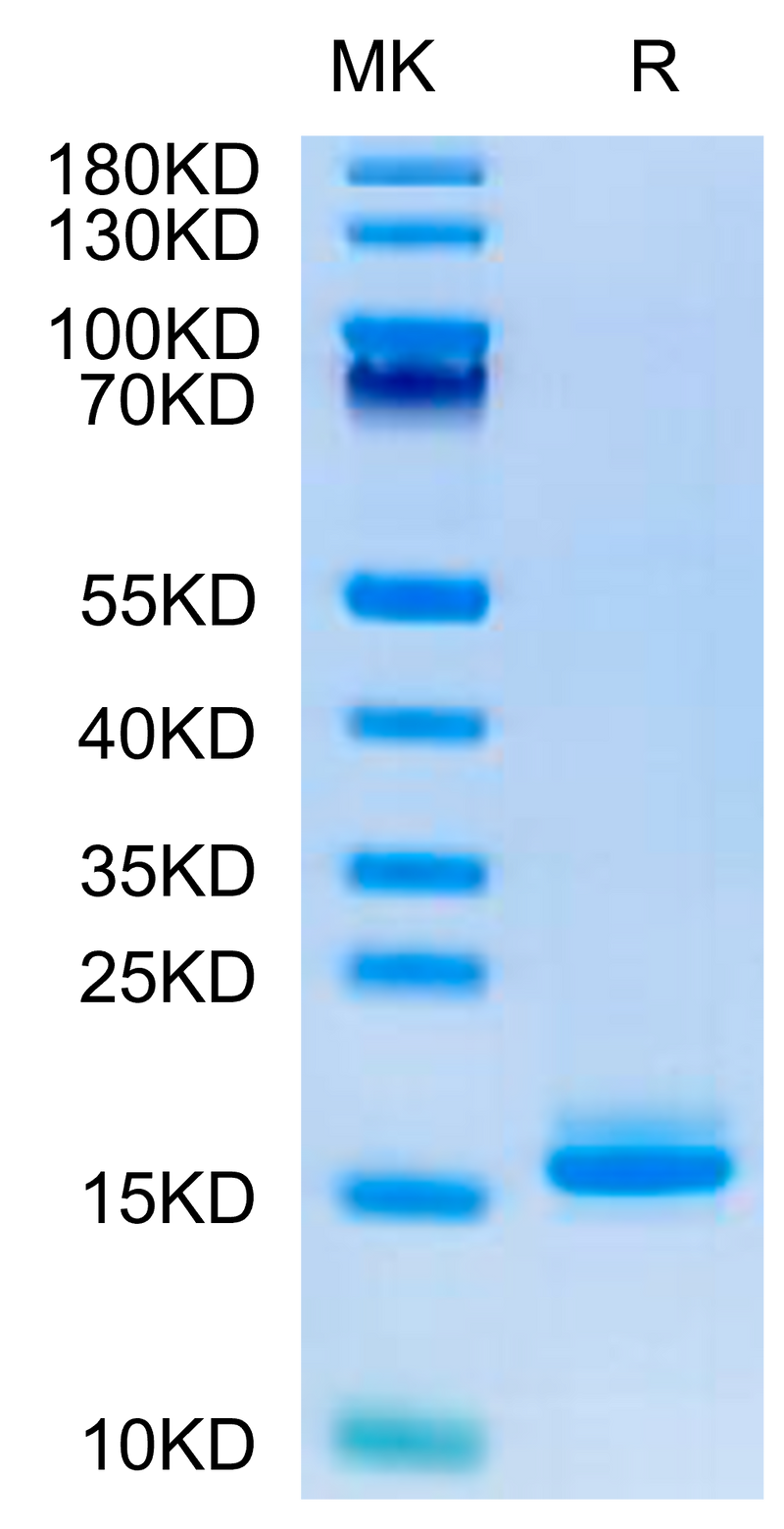 Human LILRB4 Domain 1+hinge on Tris-Bis PAGE under reduced condition. The purity is greater than 95%.Recombinant Human LILRB4/CD85k/ILT3 Domain 1+hinge Protein