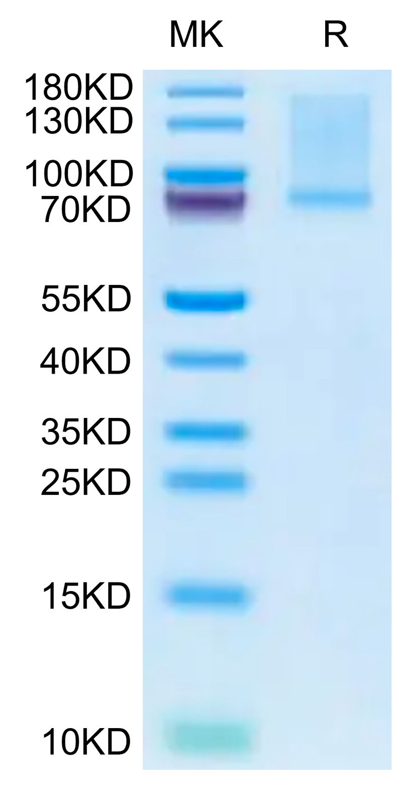 Mouse GAS6 on Tris-Bis PAGE under reduced condition. The purity is greater than 95%.Recombinant Mouse GAS6 Protein, Active