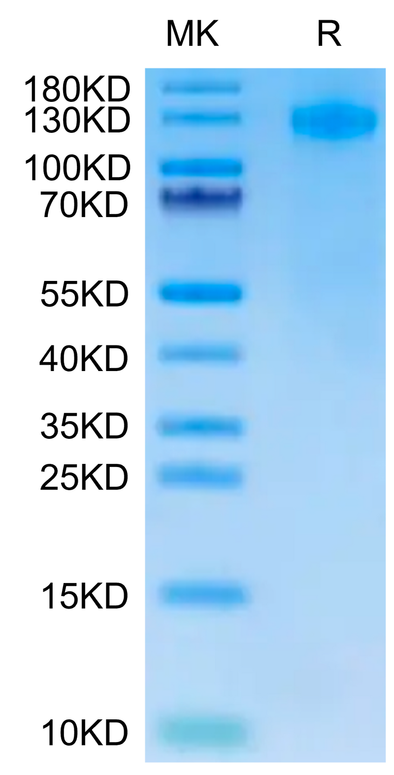 Human FcRH5 on Tris-Bis PAGE under reduced condition. The purity is greater than 95%.Recombinant Human FcRH5/FcRL5 Protein, Active