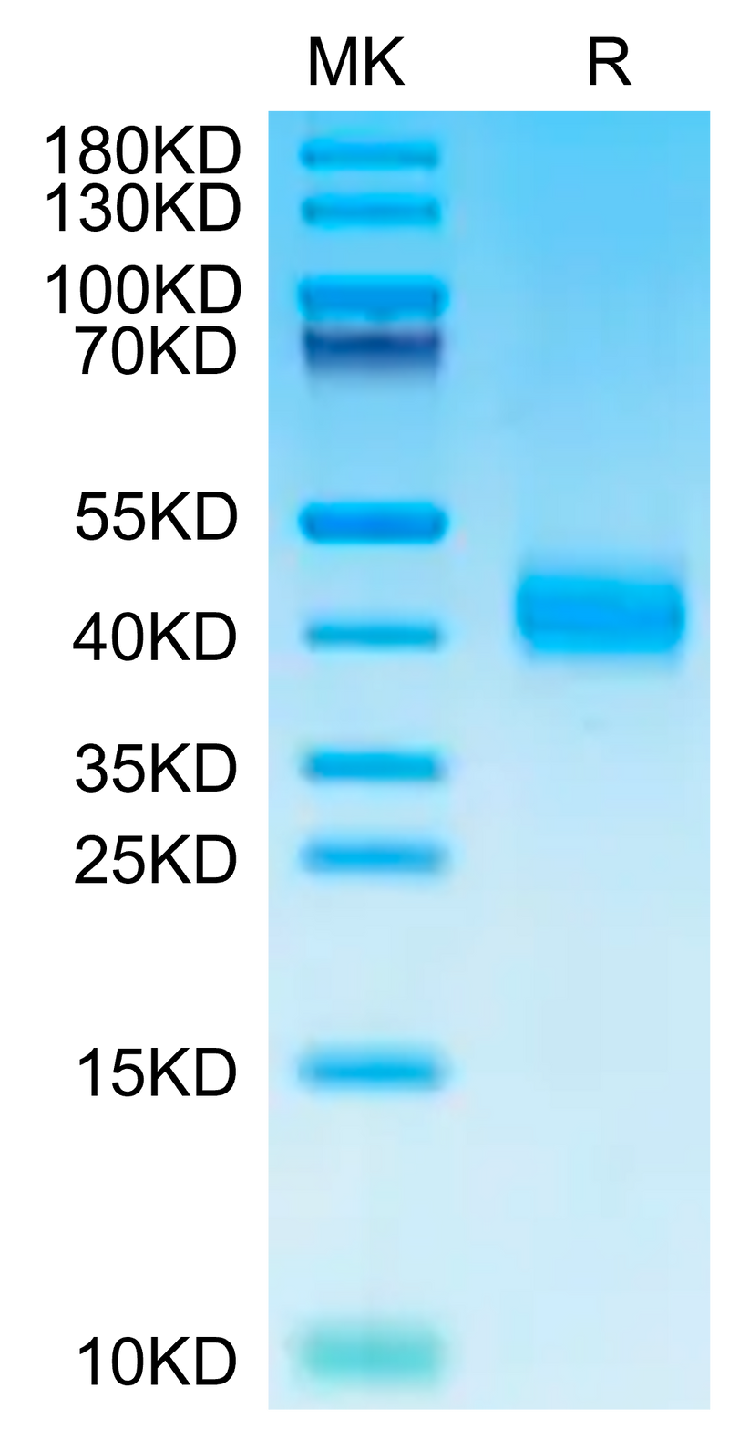 Human ASGR1 on Tris-Bis PAGE under reduced condition. The purity is greater than 95%.Recombinant Human ASGR1 Protein