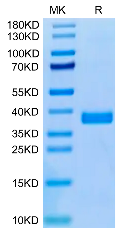 Human APOE3 on Tris-Bis PAGE under reduced condition. The purity is greater than 95%.Recombinant Human APOE3/Apolipoprotein E Protein, Active