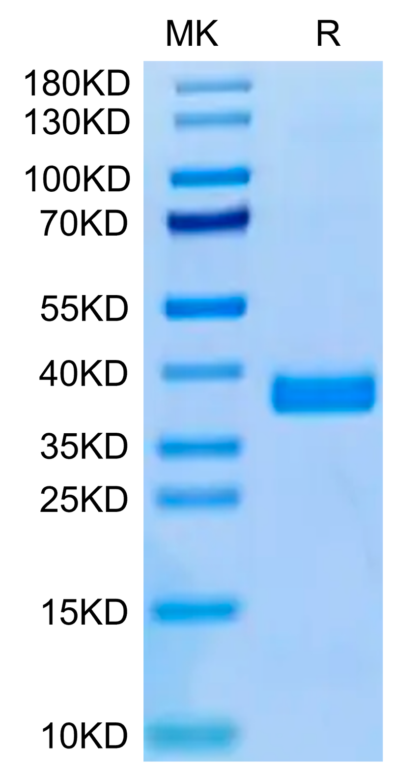 Human APOE3 on Tris-Bis PAGE under reduced condition. The purity is greater than 95%.Recombinant Human APOE3/Apolipoprotein E Protein, Active