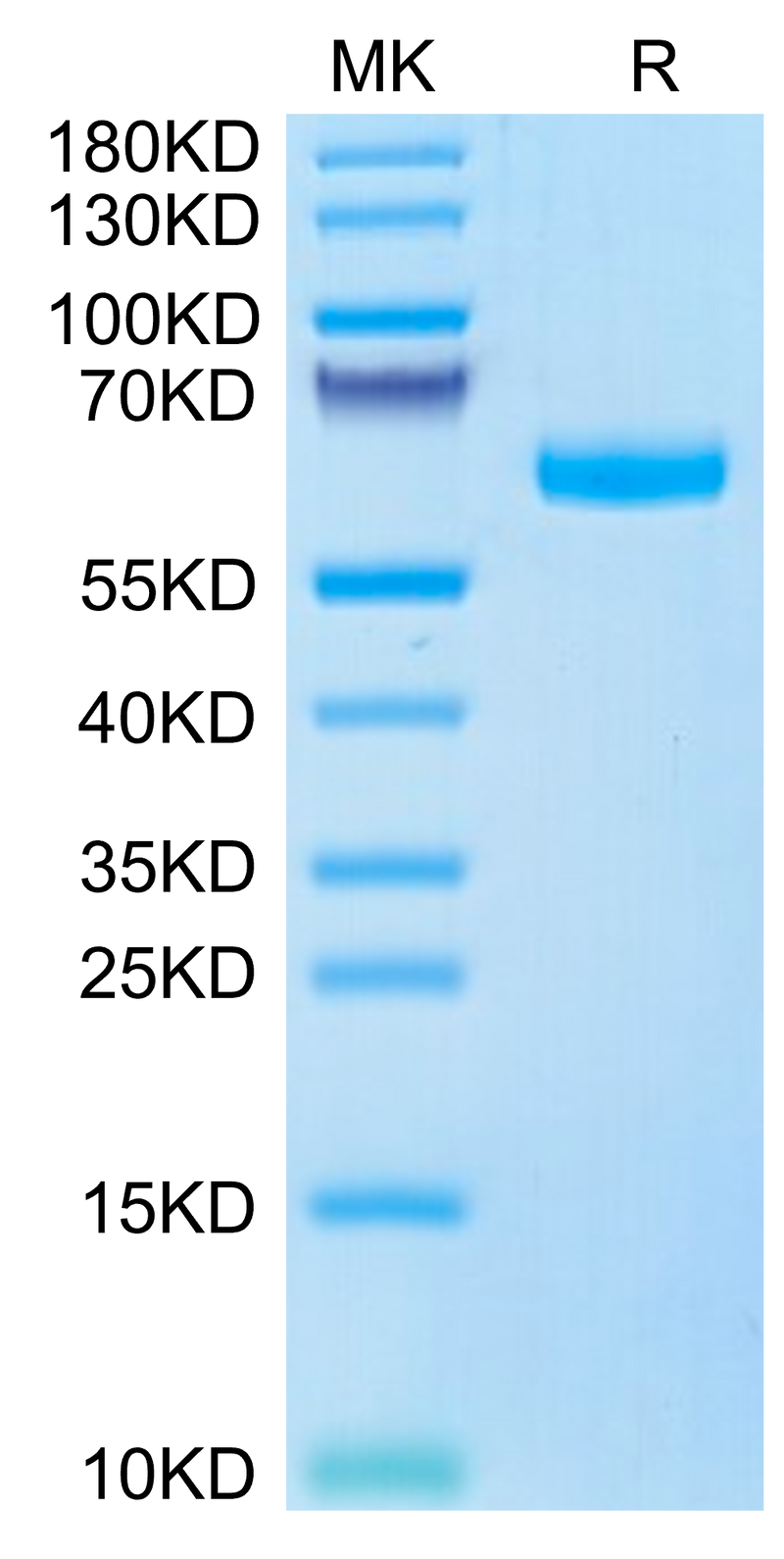 Human ULBP-6 on Tris-Bis PAGE under reduced condition. The purity is greater than 95%.Recombinant Human ULBP-6 Protein, Active