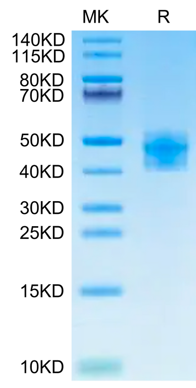 Human Fibronectin (32-345) on Tris-Bis PAGE under reduced condition. The purity is greater than 95%.Recombinant Human Fibronectin (32-345) Protein