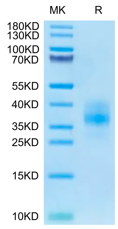 Cynomolgus BTLA on Tris-Bis PAGE under reduced condition. The purity is greater than 95%.Recombinant Cynomolgus BTLA Protein, Active