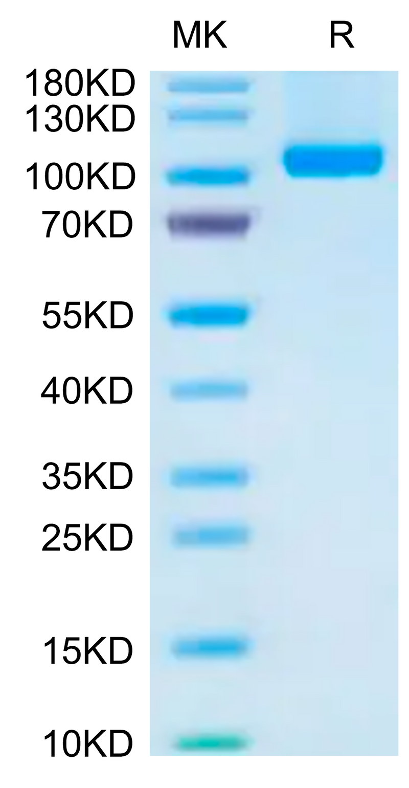 Human VAP-1 on Tris-Bis PAGE under reduced condition. The purity is greater than 95%.Recombinant Human VAP-1 Protein