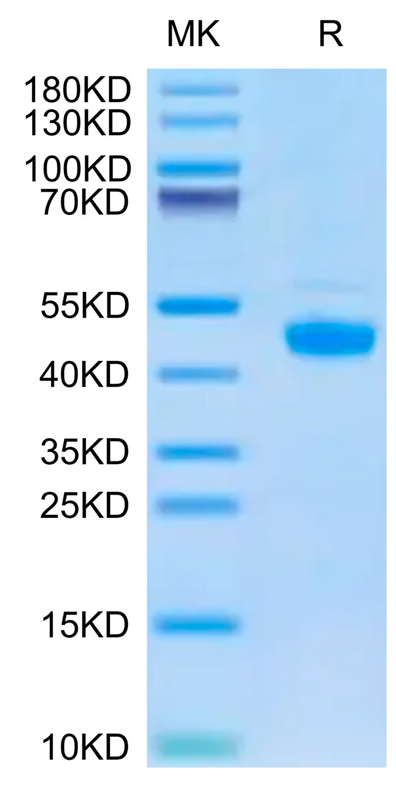 Biotinylated Human FGL2 on Tris-Bis PAGE under reduced condition. The purity is greater than 95%.Biotinylated Human FGL2 Protein, Active
