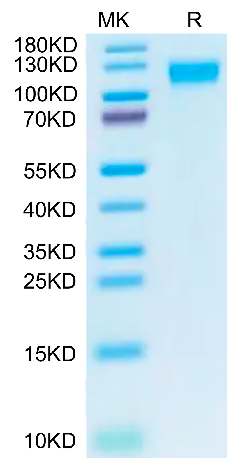Biotinylated Cynomolgus ACE2 on Tris-Bis PAGE under reduced condition. The purity is greater than 95%.Biotinylated Cynomolgus ACE2/ACEH Protein, Active