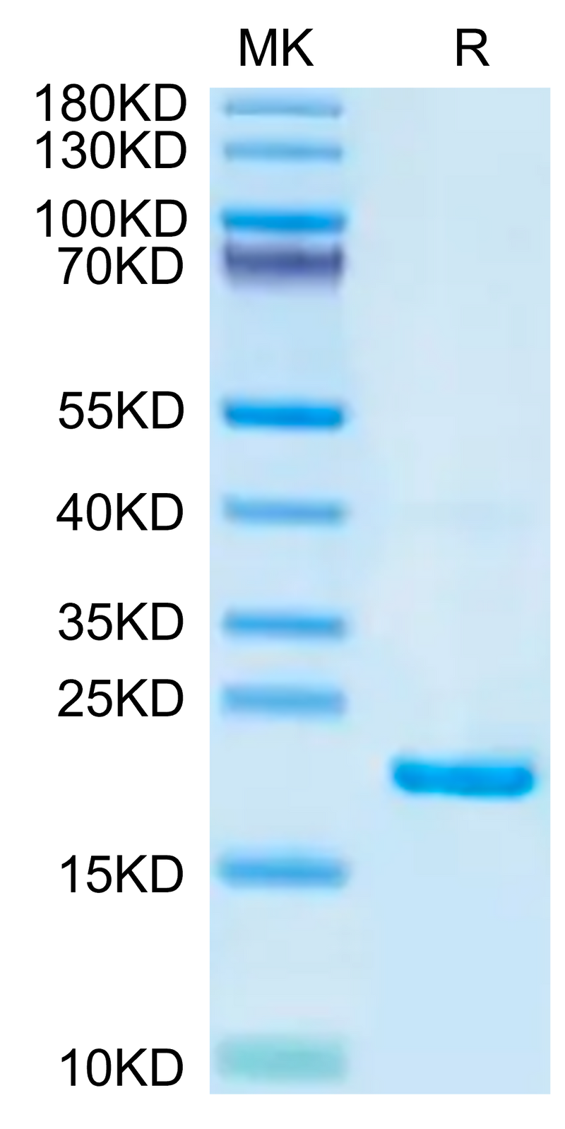 Biotinylated Mouse IL-22 on Tris-Bis PAGE under reduced condition. The purity is greater than 95%.Biotinylated Mouse IL-22 Protein, Active