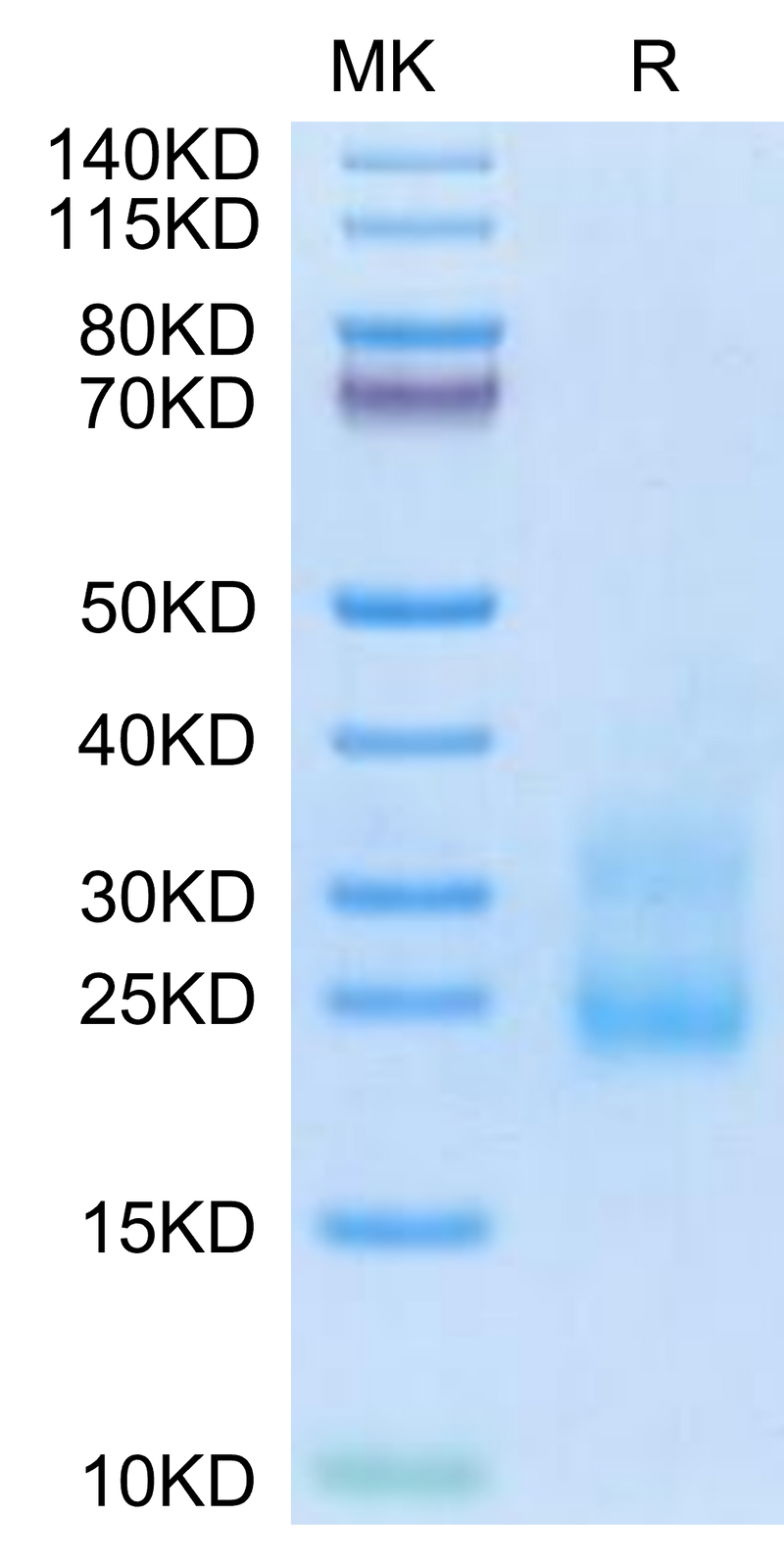 Human R spondin 3 on Tris-Bis PAGE under reduced condition. The purity is greater than 95%.Recombinant Human R spondin 3/RSPO3 Protein, Active