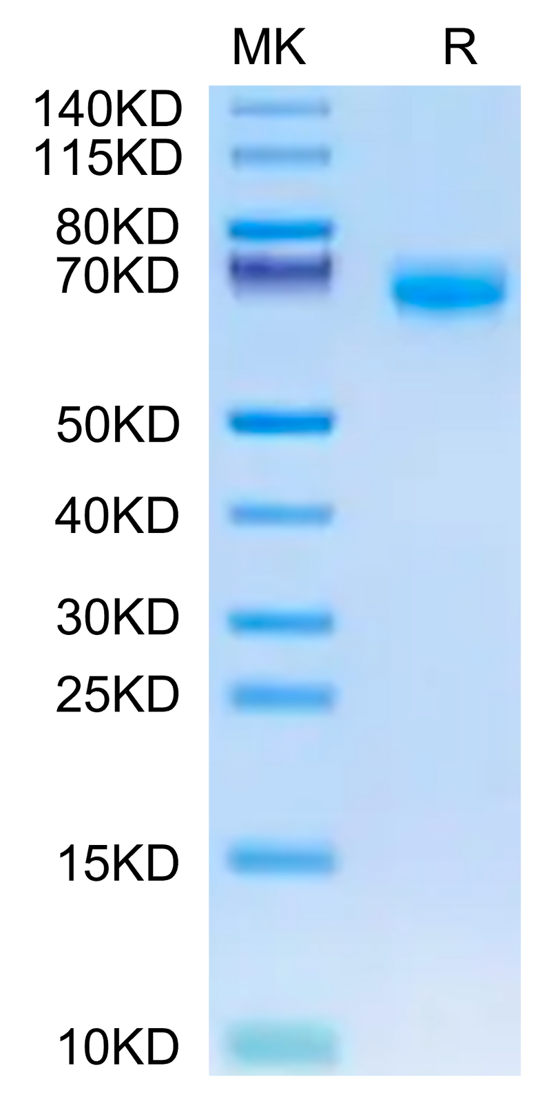 Biotinylated Mouse PD-1 on Tris-Bis PAGE under reduced condition. The purity is greater than 95%.Biotinylated Mouse PD-1/PDCD1 Protein (Primary Amine Labeling), Active