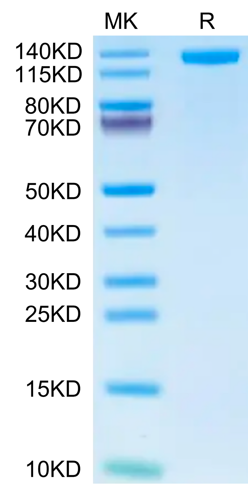 Human CD163 on Tris-Bis PAGE under reduced condition. The purity is greater than 95%.Recombinant Human CD163 Protein