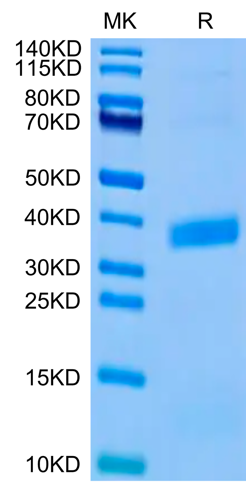 Biotinylated Human APOE3 on Tris-Bis PAGE under reduced condition. The purity is greater than 95%.Biotinylated Human APOE3/Apolipoprotein E Protein (Primary Amine Labeling), Active