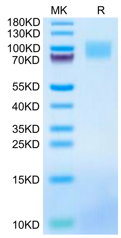 Mouse GUCY2C on Tris-Bis PAGE under reduced condition. The purity is greater than 95%.Recombinant Mouse GUCY2C/Guanylyl cyclase C Protein