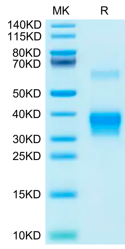 Human BDCA-2 on Tris-Bis PAGE under reduced condition. The purity is greater than 95%.Recombinant Human BDCA-2 Protein, Active