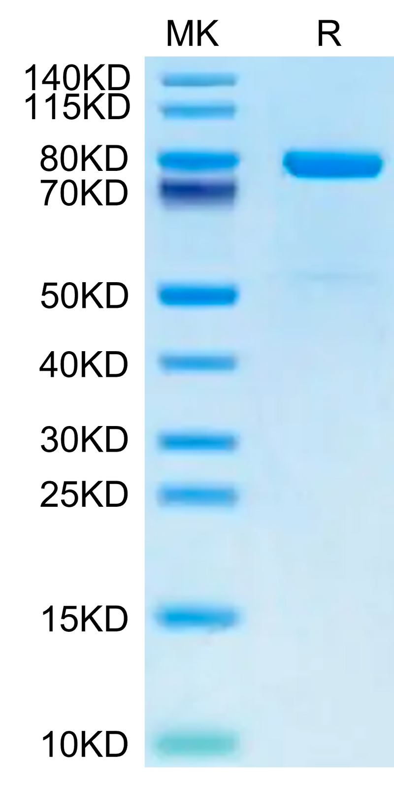 Mouse KLKB1 on Tris-Bis PAGE under reduced condition. The purity is greater than 95%.Recombinant Mouse KLKB1 Protein
