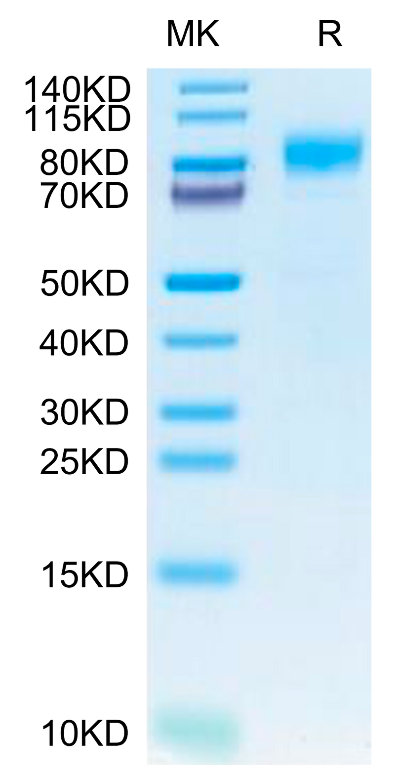 Canine PDGF R beta on Tris-Bis PAGE under reduced condition. The purity is greater than 95%.Recombinant Canine PDGF R beta/CD140b Protein, Active