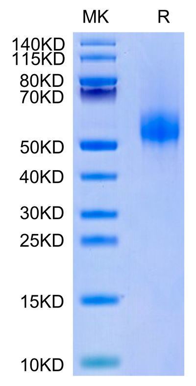 Human CDH17 Domain 5-7 on Tris-Bis PAGE under reduced condition. The purity is greater than 95%.Recombinant Human CDH17/Cadherin 17 Domain 5-7 Protein