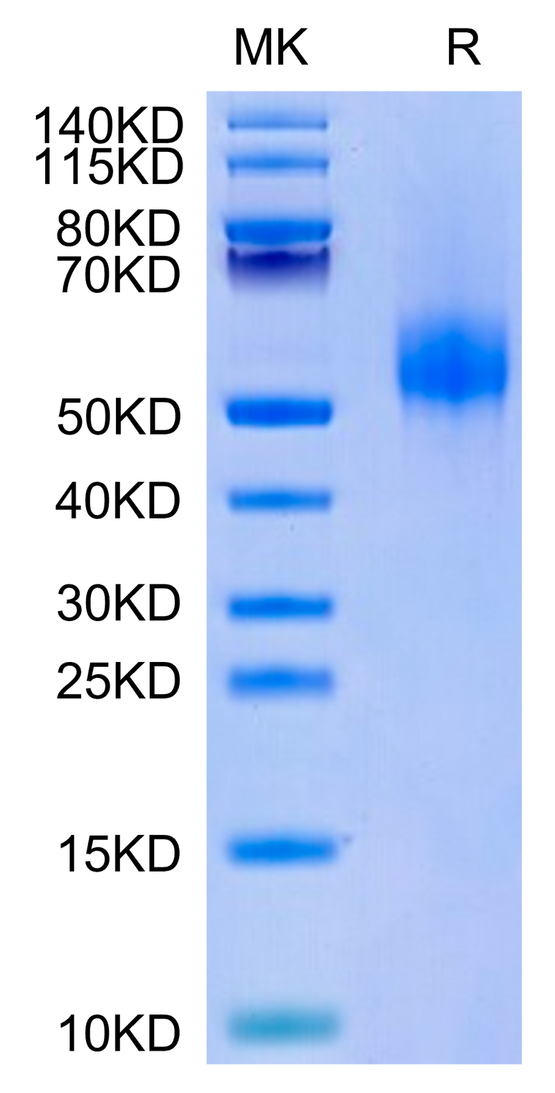 Human CDH17 Domain 5-7 on Tris-Bis PAGE under reduced condition. The purity is greater than 95%.Recombinant Human CDH17/Cadherin 17 Domain 5-7 Protein