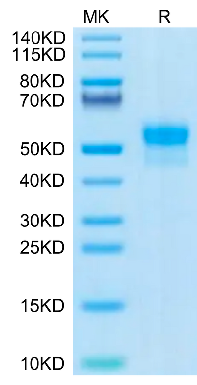Human SIRP alpha on Tris-Bis PAGE under reduced condition. The purity is greater than 95%.Recombinant Human SIRP alpha/CD172a Protein, Active