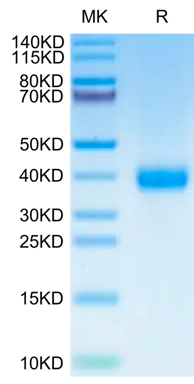 SARS-CoV-2 Spike RBD (Omicron XBB) on Tris-Bis PAGE under reduced condition. The purity is greater than 95%.Recombinant SARS-CoV-2 Spike RBD (Omicron XBB) Protein, Active