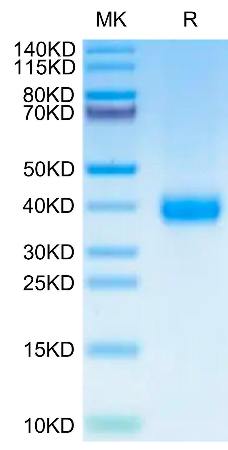 SARS-CoV-2 Spike RBD (Omicron XBB) on Tris-Bis PAGE under reduced condition. The purity is greater than 95%.Recombinant SARS-CoV-2 Spike RBD (Omicron XBB) Protein, Active