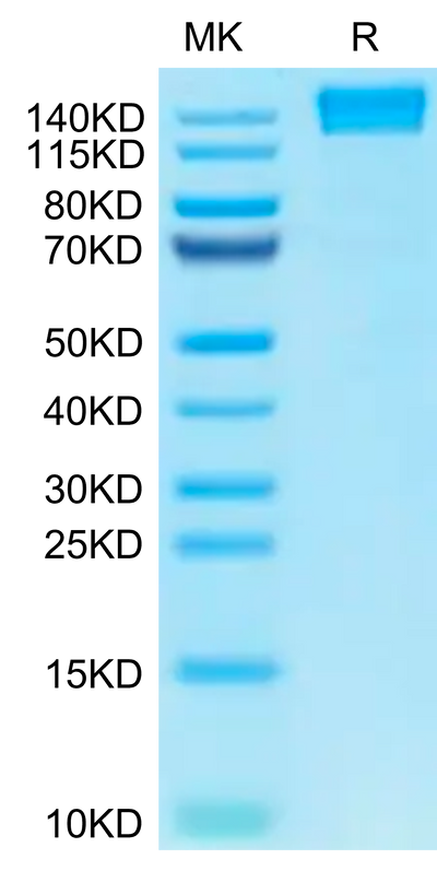 Human CD45 on Tris-Bis PAGE under reduced condition. The purity is greater than 95%.Recombinant Human CD45/PTPRC Protein, Active