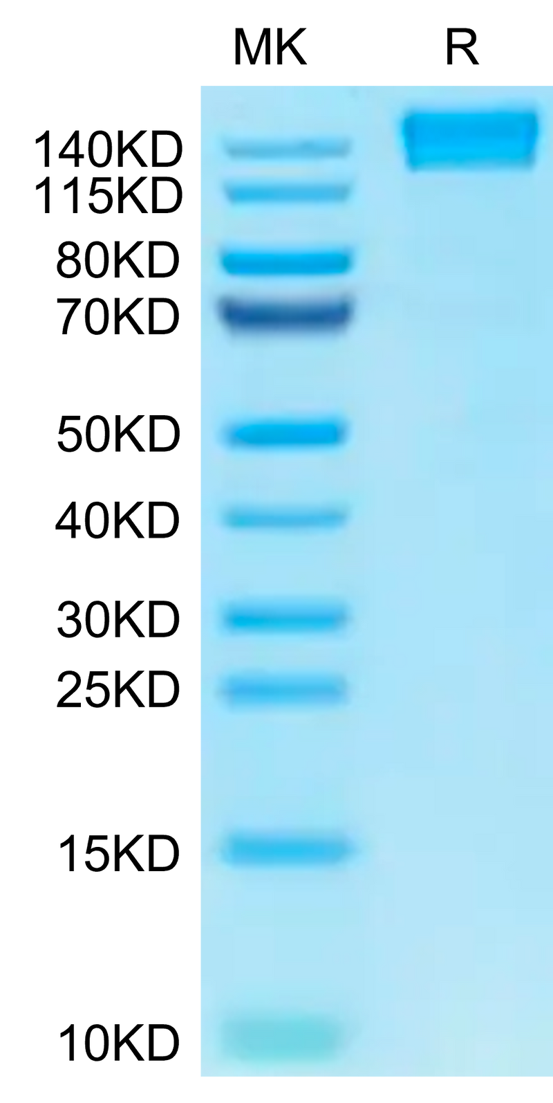 Human CD45 on Tris-Bis PAGE under reduced condition. The purity is greater than 95%.Recombinant Human CD45/PTPRC Protein, Active