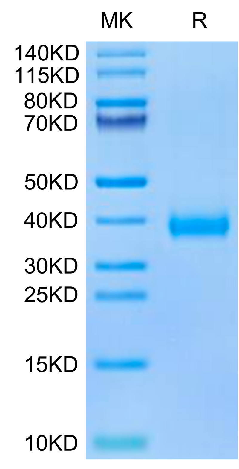 SARS-CoV-2 Spike RBD (Omicron BA.2.75) on Tris-Bis PAGE under reduced condition. The purity is greater than 95%.Recombinant SARS-CoV-2 Spike RBD (Omicron BA.2.75) Protein, Active