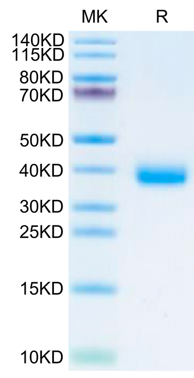 SARS-CoV-2 Spike RBD (Omicron BA.2.75.2) on Tris-Bis PAGE under reduced condition. The purity is greater than 95%.Recombinant SARS-CoV-2 Spike RBD (Omicron BA.2.75.2) Protein, Active