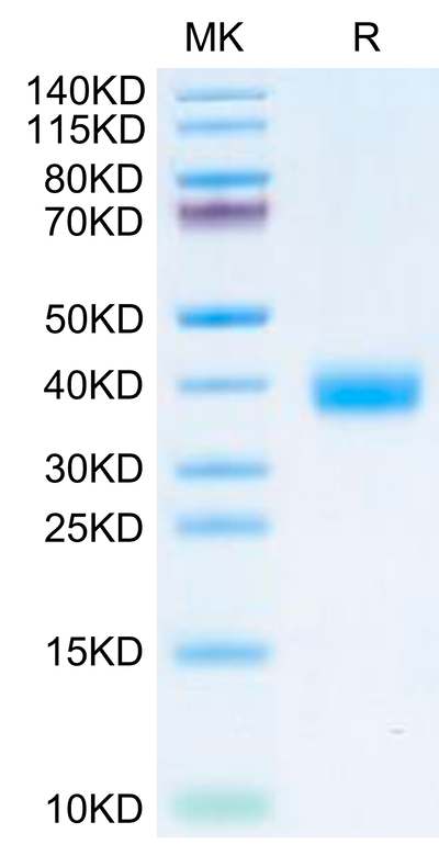 SARS-CoV-2 Spike RBD (Omicron BF.7/BA.4.6) on Tris-Bis PAGE under reduced condition. The purity is greater than 95%.Recombinant SARS-CoV-2 Spike RBD (Omicron BF.7/BA.4.6) Protein, Active